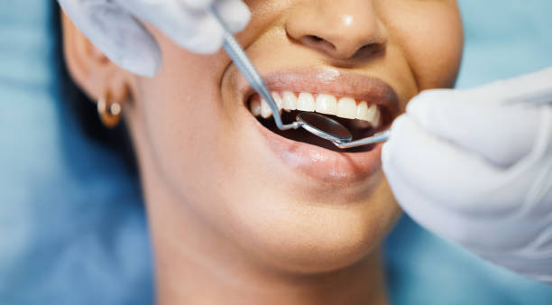 Best Dentist for Tooth Abscess  in Abbeville, AL